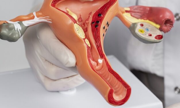 <strong>Venezuela registra repunte de cáncer de cuello uterino en zona costera</strong>