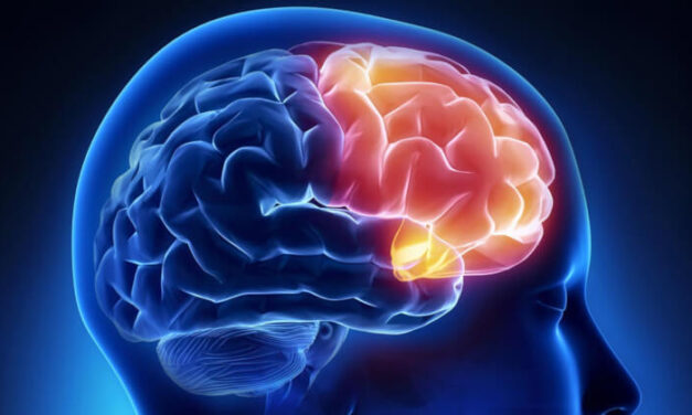 Trastorno frontotemporal ocasiona irritabilidad y dificultad al hablar