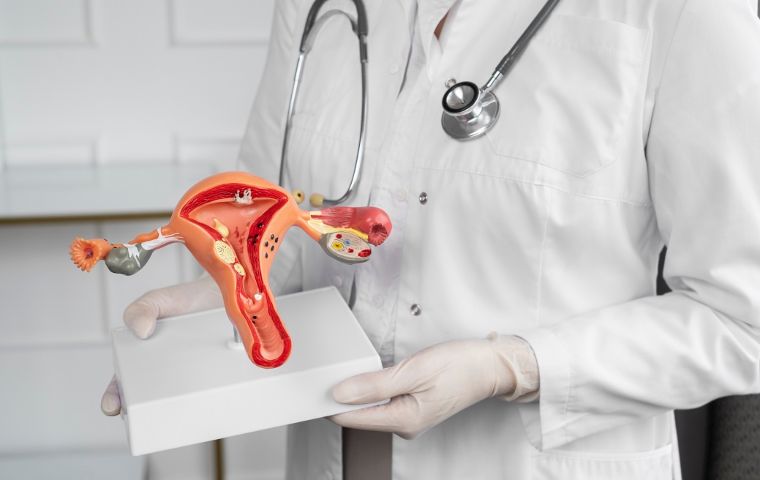 Cáncer de cuello uterino está directamente relacionado al Virus del Papiloma Humano