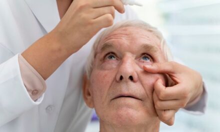 El glaucoma es una amenaza silenciosa para la visión