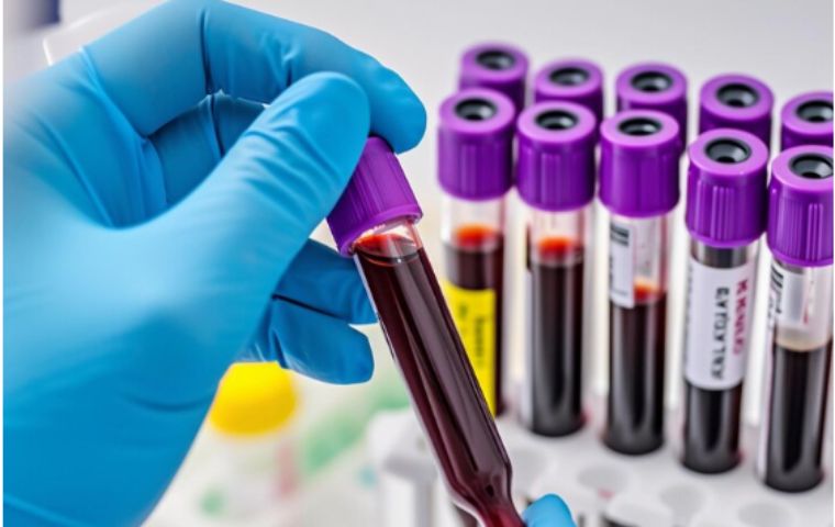 Laboratorio clínico del GMSP garantiza rapidez y confiabilidad en resultados