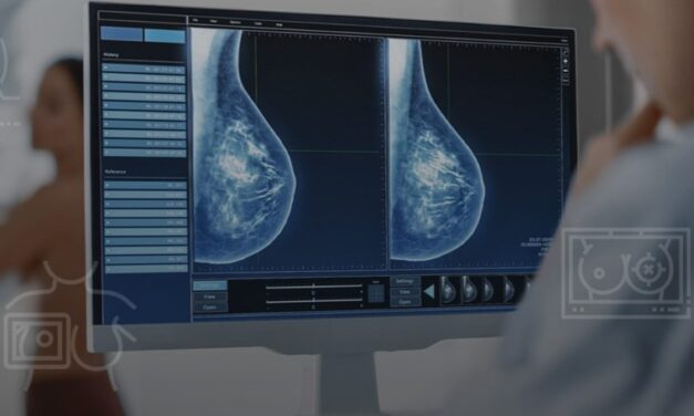 Koios: El software clave en la detección de cáncer de mama y tiroides en Venezuela