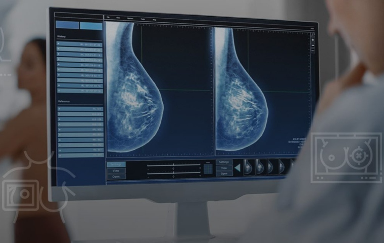Koios: El software clave en la detección de cáncer de mama y tiroides en Venezuela