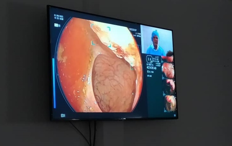 Inteligencia Artificial: Un aliado clave en la detección temprana del cáncer