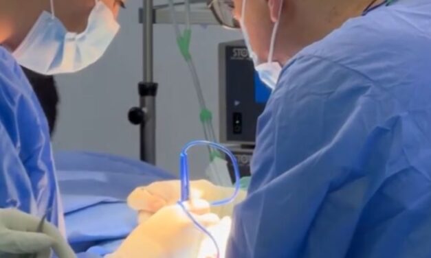 ¡Alerta con el dolor abdominal! Conoce todo sobre los cálculos en la vesícula