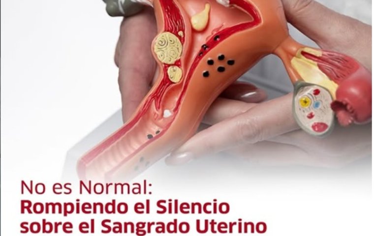 Sangrado uterino anormal afecta al 30% de las mujeres