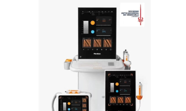 SAV incorpora tecnología FibroScan para detectar a tiempo riesgo de cirrosis y cáncer hepático