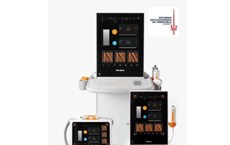 SAV incorpora tecnología FibroScan para detectar a tiempo riesgo de cirrosis y cáncer hepático