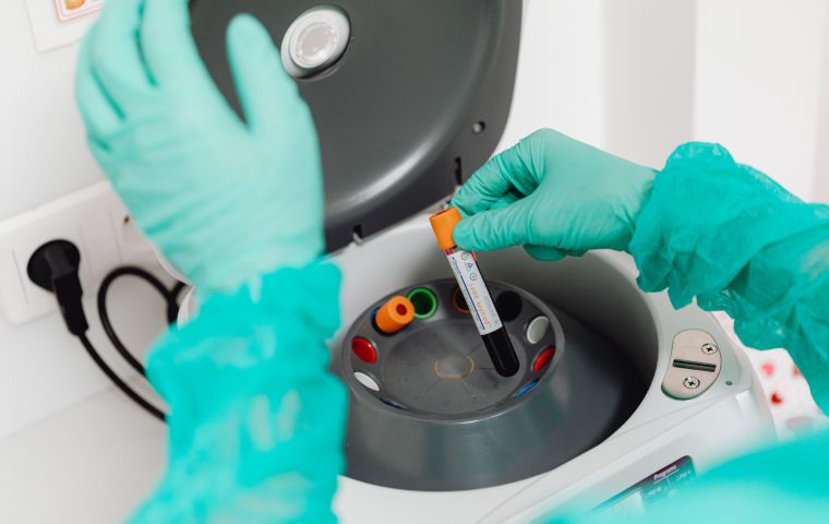 Perfil 20: El análisis de laboratorio fundamental para la detección temprana de enfermedades